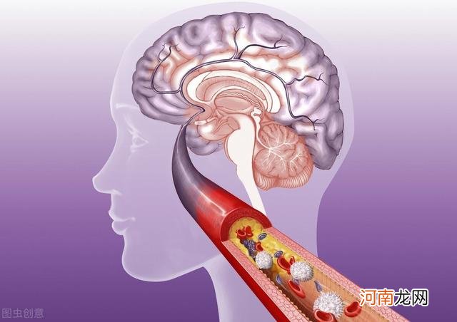 心脑血管病人只能吃素？医师：这4种素食，也会给血管“添堵”