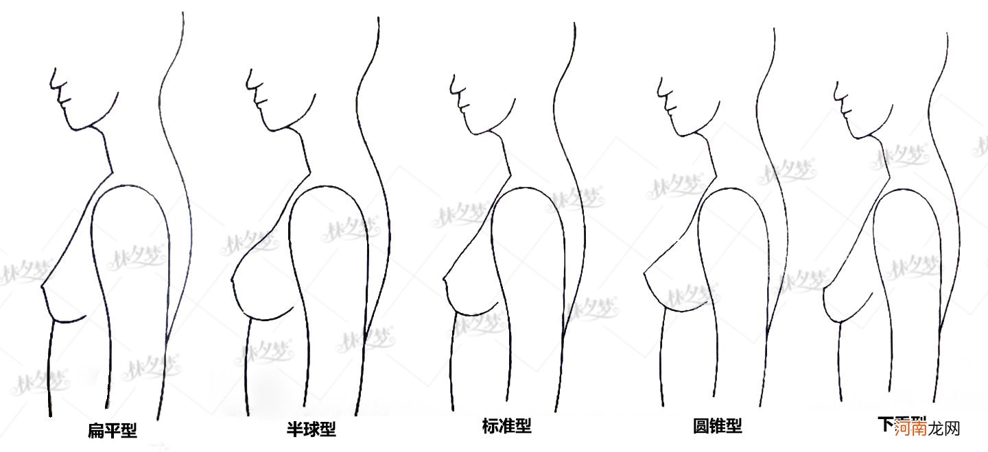 乳房上长了疣的图片