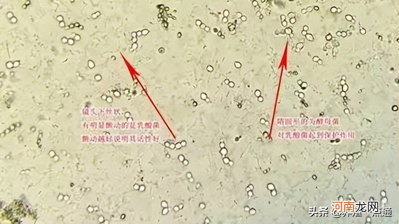 乳酸菌在水产养殖中的七大作用 乳酸菌在水产养殖中的作用