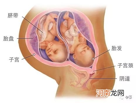 怀孕12周孩子的图片