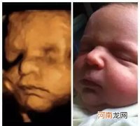 孕12周男女宝宝b超图