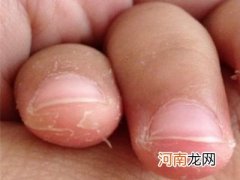 手指甲上的月牙是怎么回事