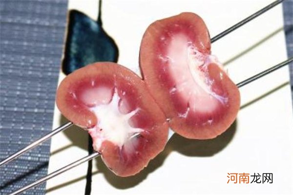 羊腰子正中间白色的能吃吗 羊腰子正中间白色物体要去掉吗