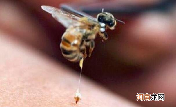被蜜蜂蛰了该怎么办