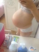 孕晚期妊高症能顺产吗