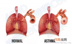 儿童支气管哮喘的一些食疗方法