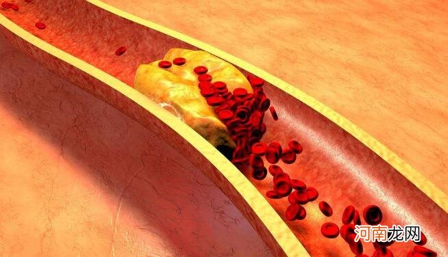胆固醇高表明哪些