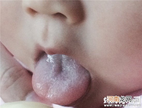 为何宝宝舌头发红 妈妈必知宝宝舌头的健康信号