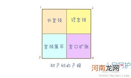 宫颈弹性不好能顺产吗