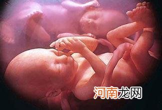 17周的胎儿有多大图片