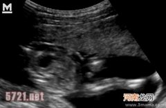 12月8日宝宝两个月，B超第一次见到宝宝