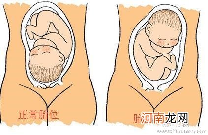 三种矫正胎位不正的方法