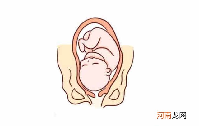 孕晚期胎位不正怎么办