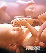 多胞胎在妈妈肚子里