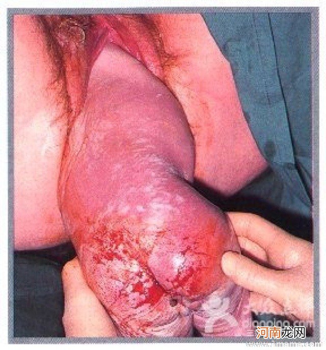 顺产后50天小腹隐隐疼