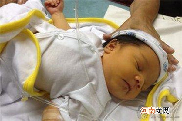 婴儿降黄疸的小妙招
