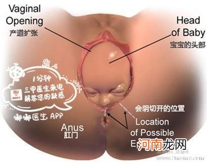 顺产是不是都要切一刀