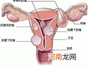 女性子宫内膜薄的那些事儿