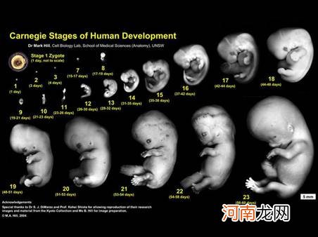 孕妈勿信关于胎儿性别的不靠谱说法