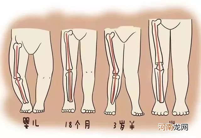 这8种凉鞋千万别给孩子穿！伤了骨头后悔就晚了！