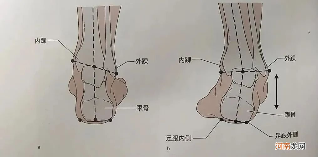 这8种凉鞋千万别给孩子穿！伤了骨头后悔就晚了！