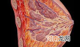 乳腺结节流黄水严重吗