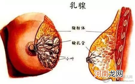 乳腺结节流黄水严重吗