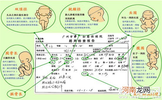 胎儿入盆了是什么意思 对于胎儿入盆孕妈要做何准备