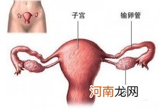 输卵管堵塞易导致女性不孕