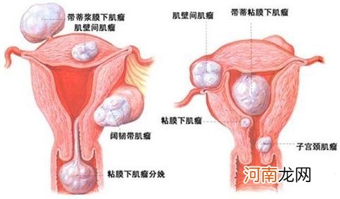 明明有排卵 为何还会不孕