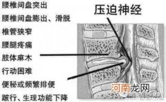 手足口病是由于什么原因引发的呢