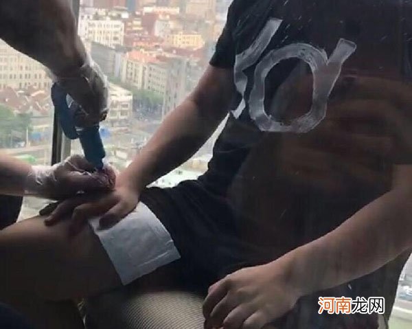 uzi手怎么受伤的 恐怕难以痊愈粉丝劝退役