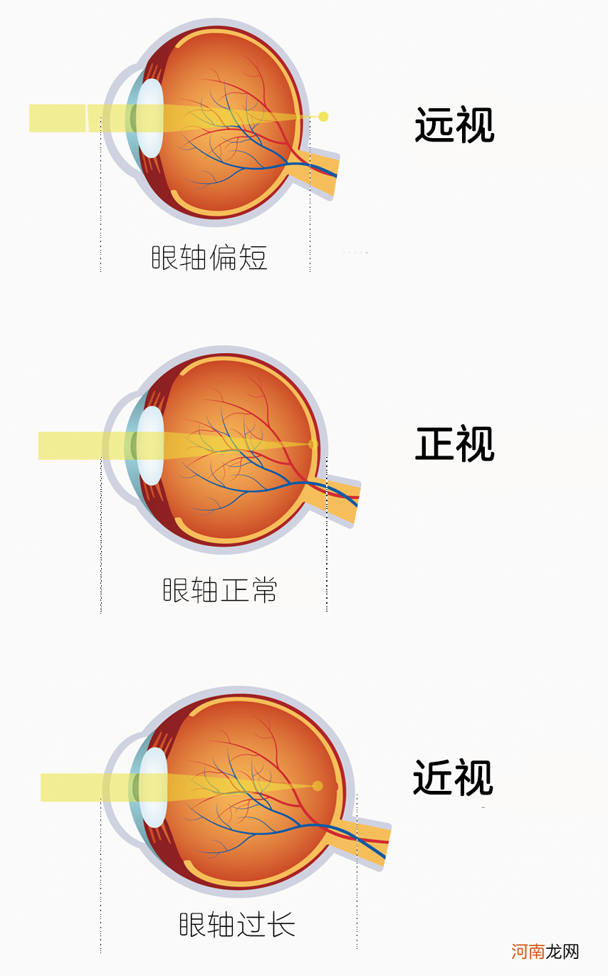 预防宝宝近视的一个关键，很多爸妈都没搞清楚