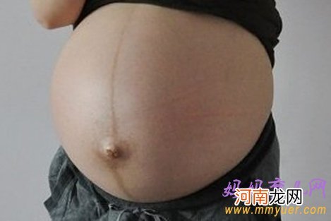 看妊娠纹判断生男生女超准 生儿子的妊娠线图片