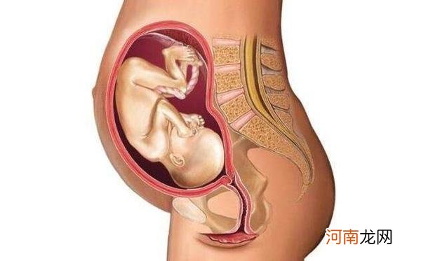 什么原因导致胎位不正