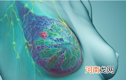 乳腺结节用什么中药敷