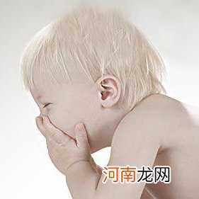 新生儿黄疸高图片