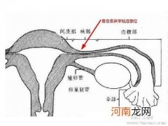 不孕不育治疗必做的精浆生化检查