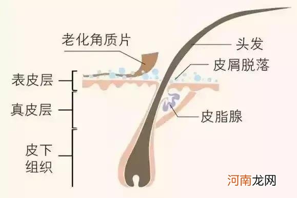 头皮屑如何选择洗发水 头皮屑如何选择洗发水