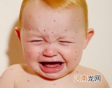 怎样帮小孩预防麻疹