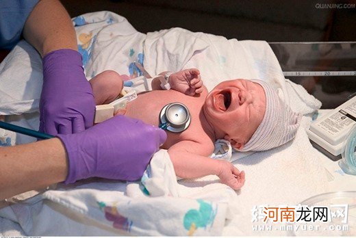 新生儿是不是都长得丑　揭秘新生宝宝的各种“丑态”