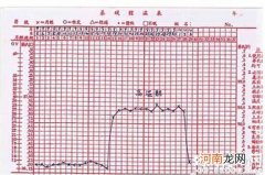 一直很好奇喜脉是怎么跳的 今天终于找到答案了