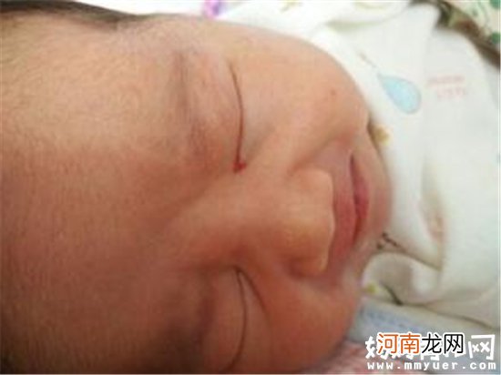 为什么宝宝眼屎多又黄 宝宝眼屎多的多种原因