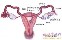 造成输卵管不孕的原因以及治疗方法