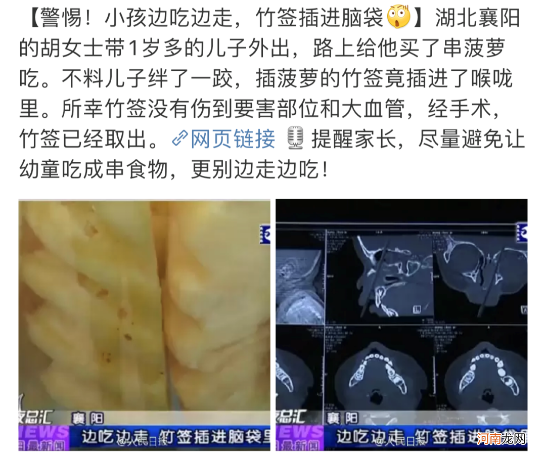 一口粽子吃进医院！这5类危险食物，千万别随便给宝宝吃！