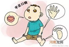 手足口病的有效预防办法有哪些