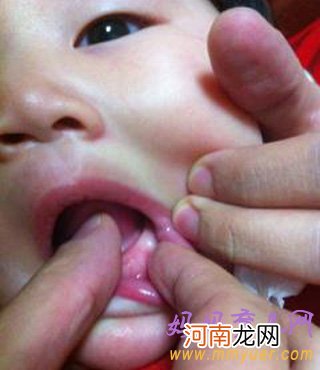 图片 宝宝长牙牙龈变化