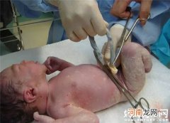 新生儿肚脐沾水咋办 新生宝宝的肚脐护理知识