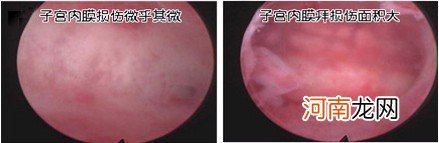 第一次会不会怀孕