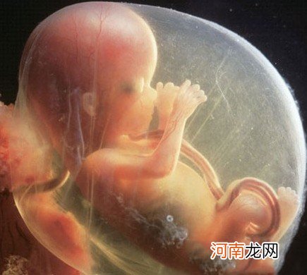 B超图 怀孕四个月胎儿图